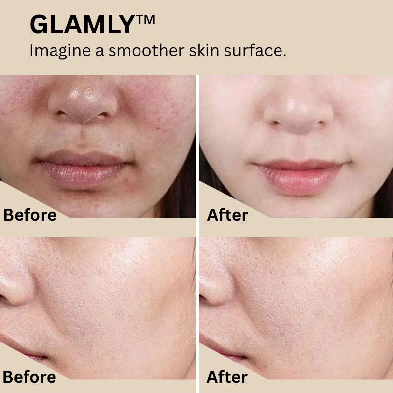 GLAMLY™ Peel Shot Rice Serum