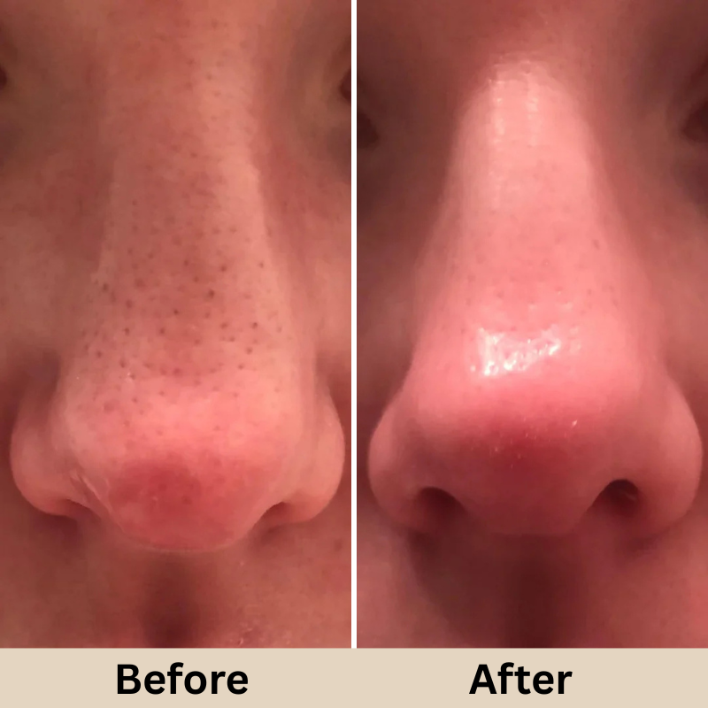 GLAMLY™ Peel Shot Rice Serum