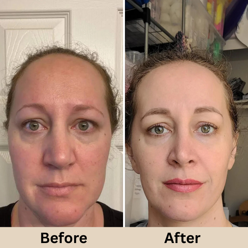 GLAMLY™ Peel Shot Rice Serum