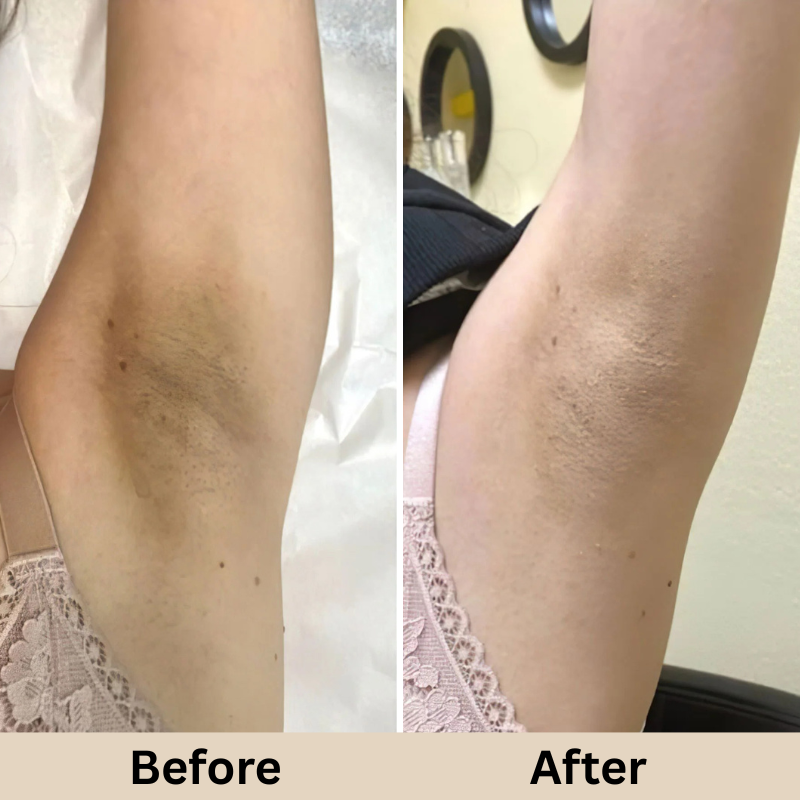 GLAMLY™ Peel Shot Rice Serum