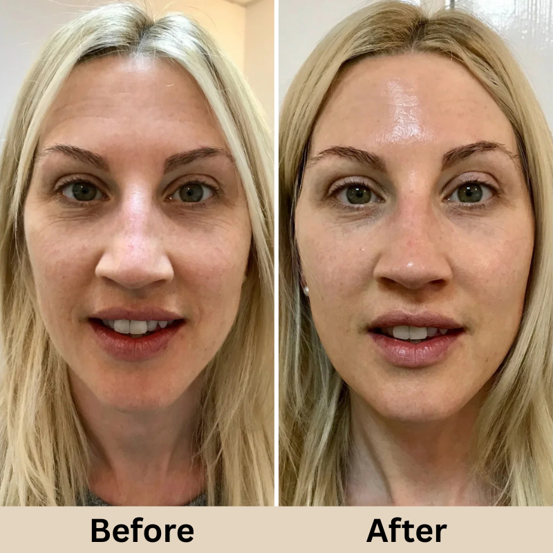 GLAMLY™ Peel Shot Rice Serum