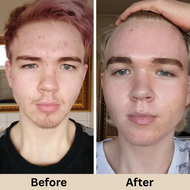 GLAMLY™ Peel Shot Rice Serum