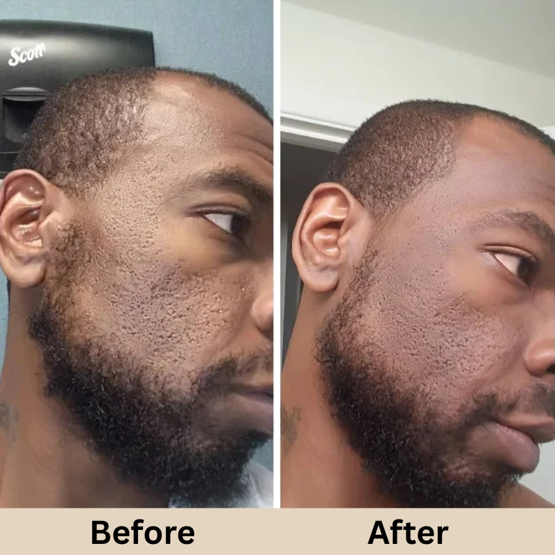 GLAMLY™ Peel Shot Rice Serum