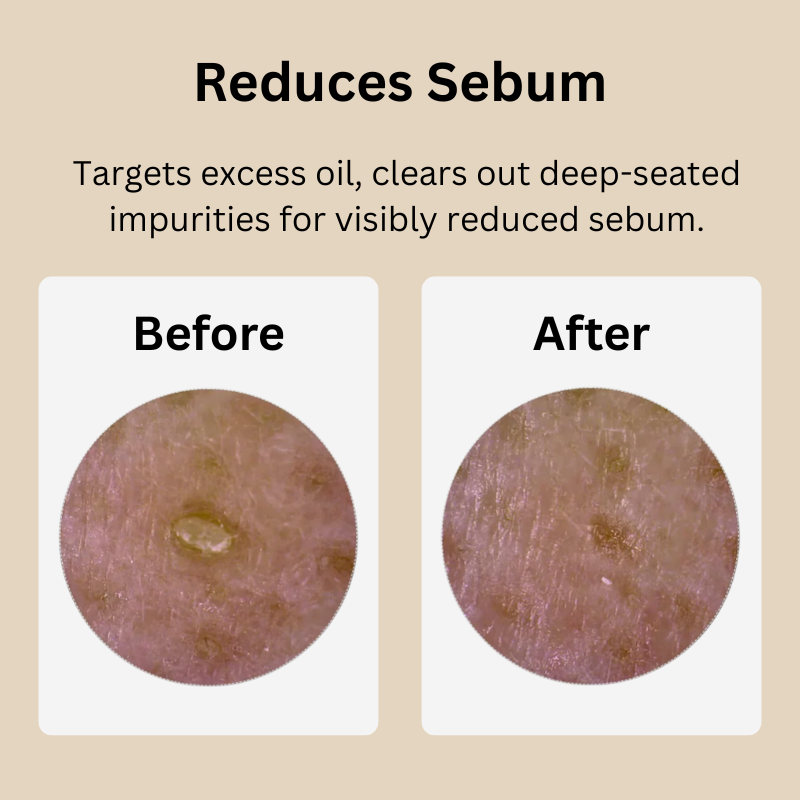 GLAMLY™ Peel Shot Rice Serum